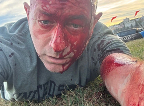 PM lightning rod for anger as Bondi victims farewelled