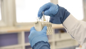 New stool test may make painful colonoscopies less necessary